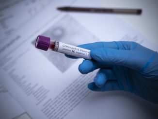 coronavirus france dépistage
