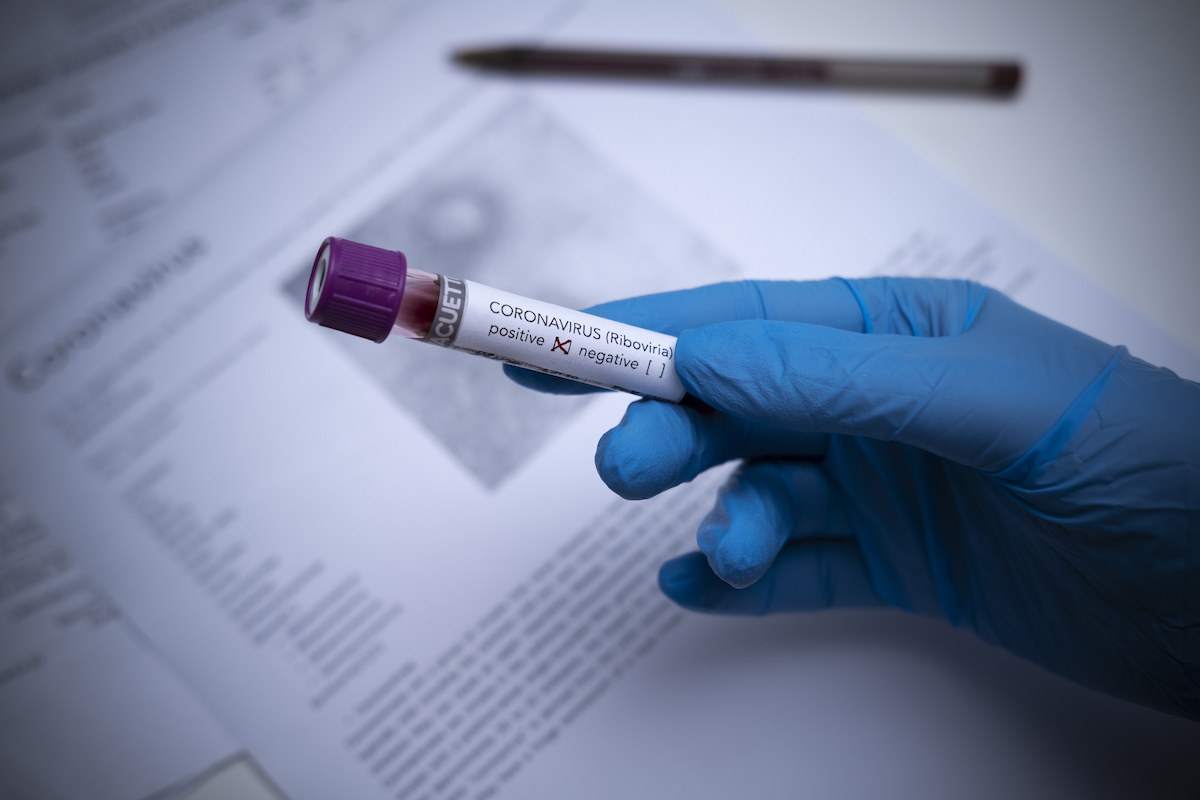 coronavirus france dépistage