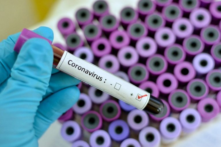 coronavirus tests