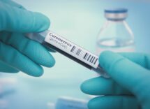 antibody test coronavirus
