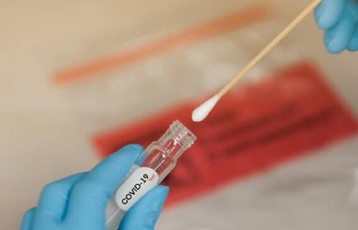 Coronavirus, dove fare il tampone a Milano: gli indirizzi