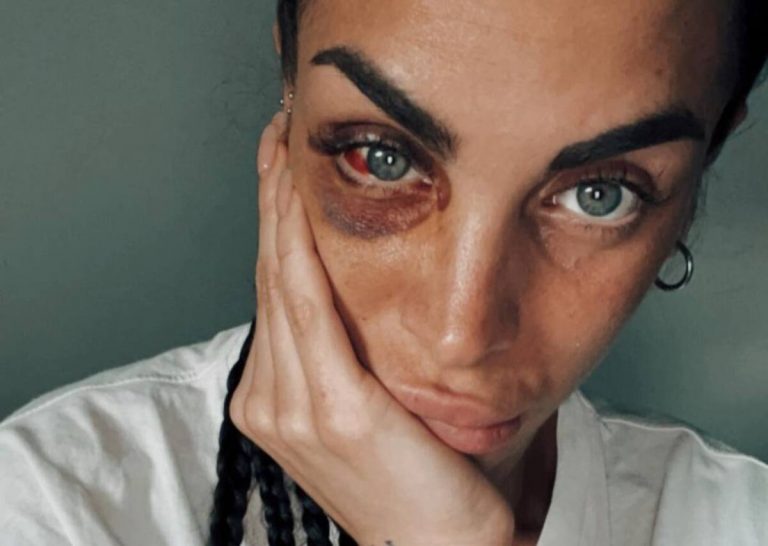 Ladro ruba pantaloncini e picchia selvaggiamente la commessa: arrestato