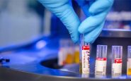 Coronavirus: swabs sent to Germany