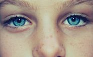 how to remove freckles