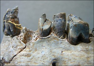 dentures zoom1 300x211