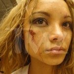 Tila Tequila beaten at a concert photos 2 150x150