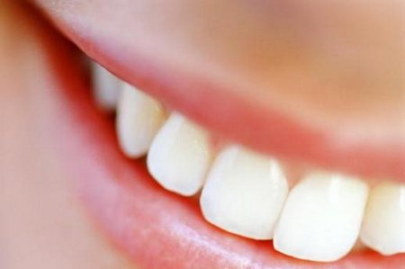 risparmiare dal dentista