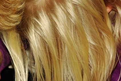 article-new_ehow_images_a06_hu_hd_dermatologic-diet-healthy-hair-scalp-800x800