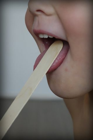 Come rimuovere pezzi di cibo dalle tonsille