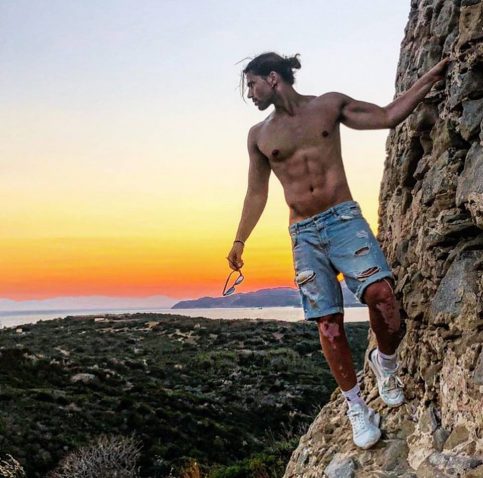 Cos'ha sulle gambe Luca Onestini