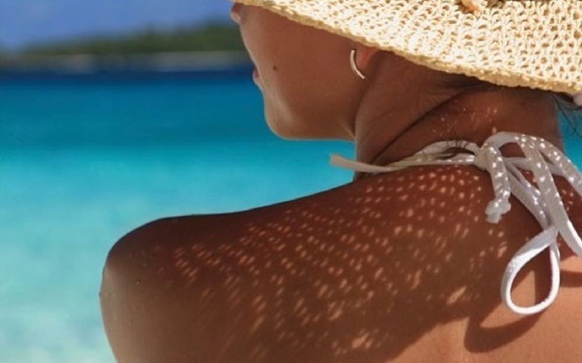 Cortisone e sole: tutti gli effetti collaterali