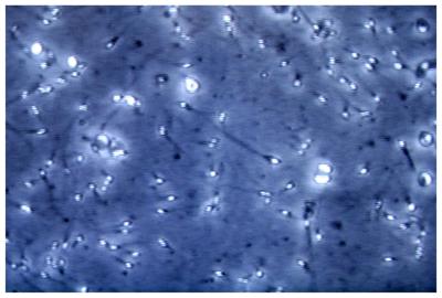 Infertilit&agrave; maschile, dietro c'&egrave; gene mancante: spermatozoi sono 'sconnessi'