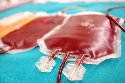 Sanità: Cns, +4,3% raccolta plasma in 2024 ma Italia non è ancora autosufficiente