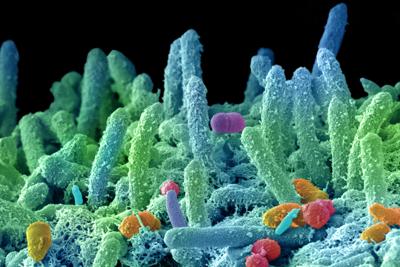 Sanità: infezioni da super batteri costano circa 1 mld l'anno, Roadmap con 10 priorità