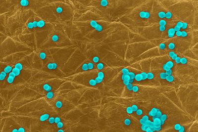 Infettivologi: "Allarme superbatteri resistenti, 11 mila morti all’anno"