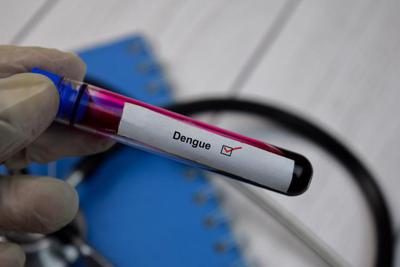 Dengue: Vaia, 'al lavoro per test volontari e gratuiti a chi arriva da Paesi a rischio'