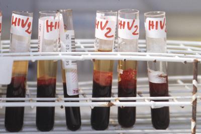 'Parliamo di Hiv oggi. Per guardare al domani', al via la seconda stagione del webinar promosso da Adnkronos