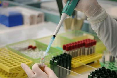 Cancro pancreas, svelati alcuni meccanismi chiave all'origine: la scoperta tutta italiana