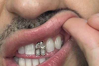 Gioielli sui denti, &egrave; grillz mania: possibili rischi