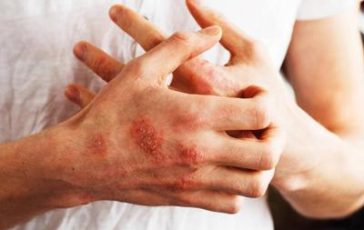 featured 1959855 364x230