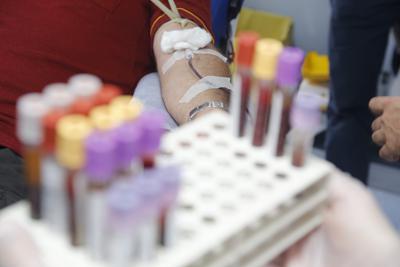 Egpa, l'esperto: "Diagnosi difficile ma con anti Il-5 ottimi risultati"