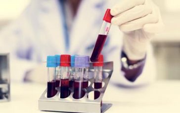 featured 1968966 364x230