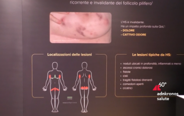 featured 1970681 364x230