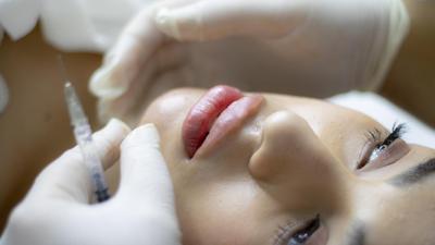 Bellezza: +20% botulino in Italia, ritocchi senza bisturi 2 volte pi&ugrave; graditi