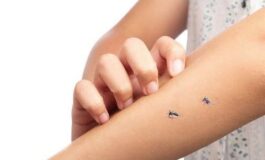 Come difendersi dalle zanzare in estate: consigli e rimedi naturali