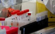 Allarme legionella a Milano