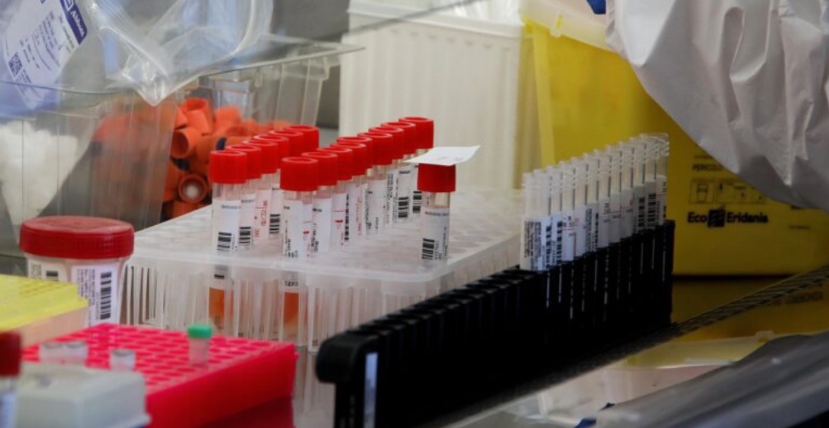 Allarme legionella nel milanese: 53 contagi e 4 morti in pochi mesi