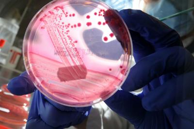Escherichia coli, allarme dopo hamburger McDonald's: 49 casi e 1 morto