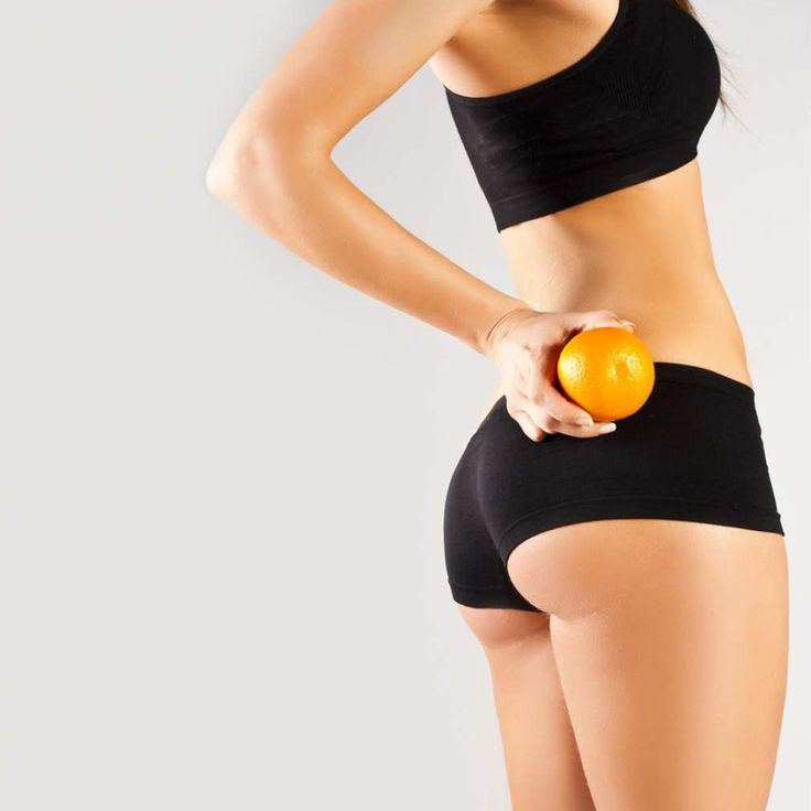 Cellulite persistente: gli alimenti per combatterla