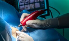 4 chirurgia dermatologica 265x160