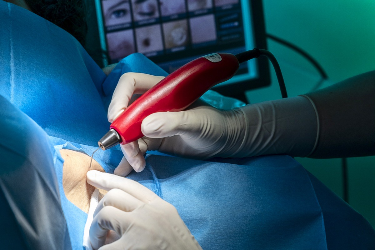 Chirurgia Dermatologica: cos'è e a cosa serve?