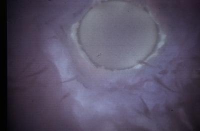 Infertilit&agrave; maschile, trovati batteri in liquido seminale che 'tagliano' spermatozoi