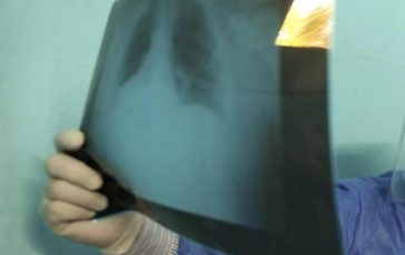 featured 2119198 364x230