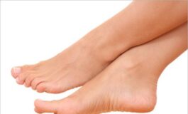 Talloni screpolati: cause e rimedi naturali