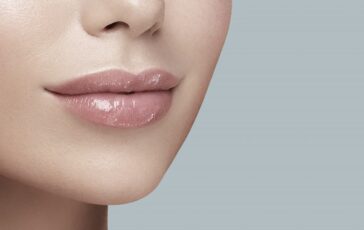 4 filler labbra 1 364x230