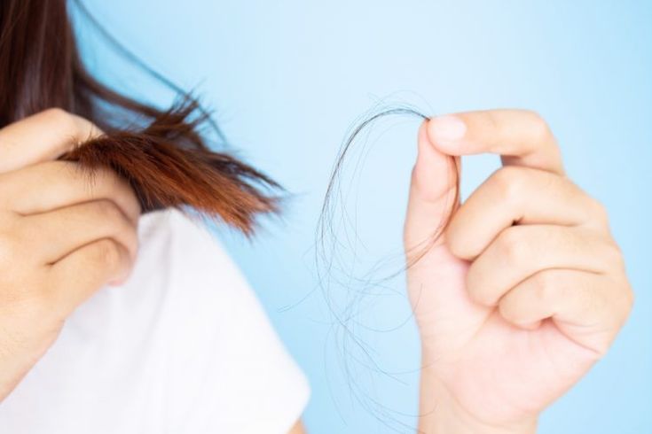Caduta dei capelli in inverno: cause e rimedi naturali