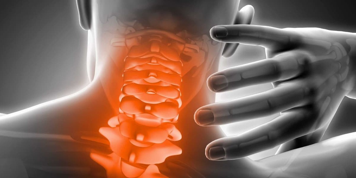 Cura cervicalgia: come riconoscere i sintomi e prevenirla in maniera efficace