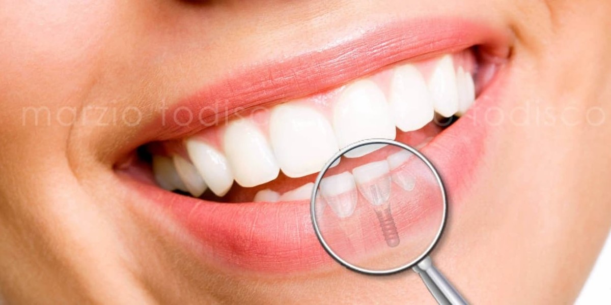 Estetica dentale e cosmesi: Il segreto di un sorriso perfetto