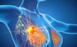 featured 2145546 265x160