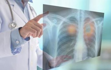 featured 2147042 364x230