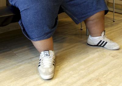 Iss, 40% adulti con problemi di peso, 1 su 10 è obeso