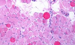 featured 2150936 265x160