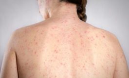 featured 2152969 265x160