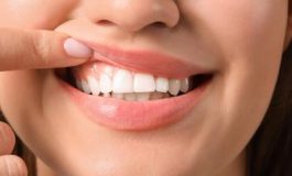 featured 2156783 265x160