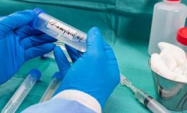 featured 2160630 265x160