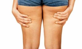 Ritenzione idrica: come eliminarla con la dieta e l’esercizio fisico